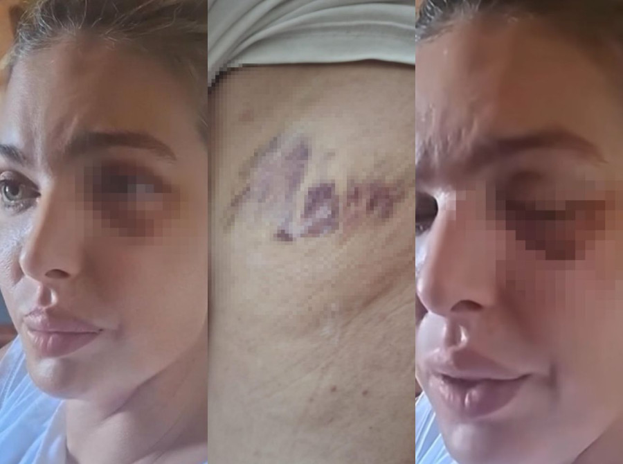 Ava Karabatić progovorila o paklu koji je preživela: Snimak na TikToku potresao region. Nijedna žena ne sme da trpi nasilje