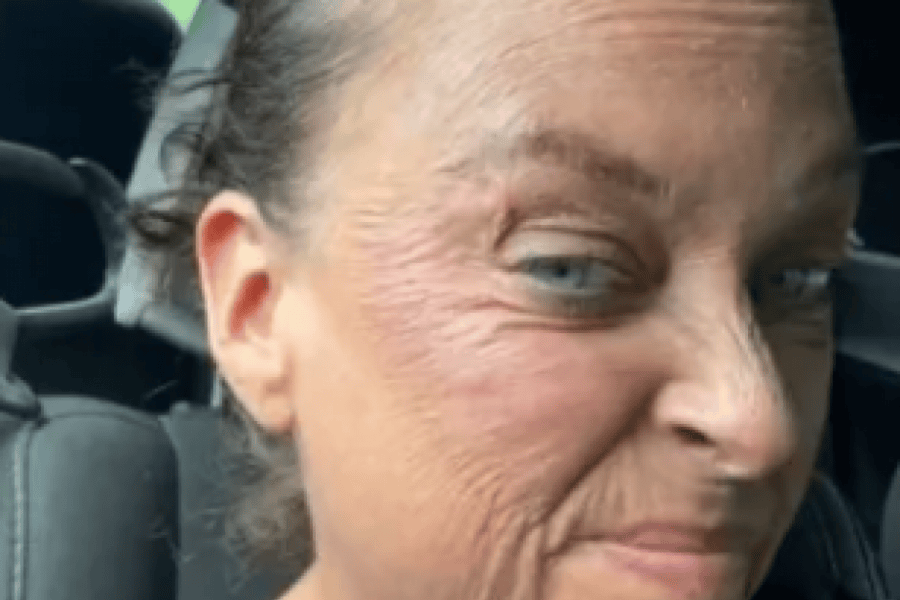 retinol