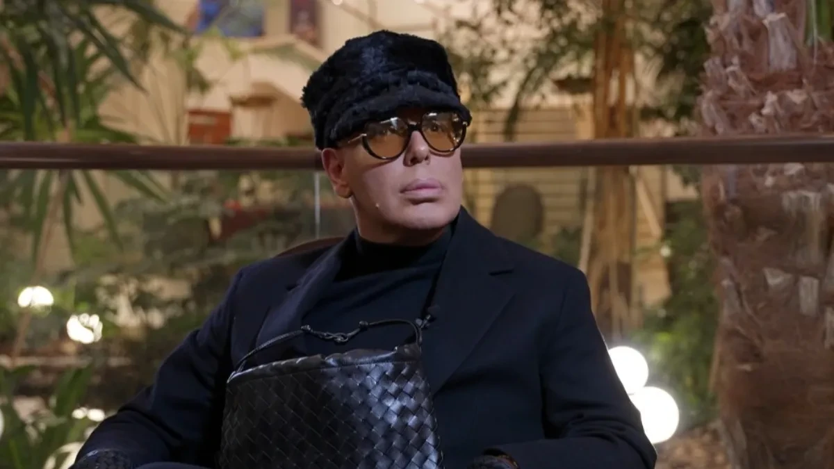 EVO KAKO JE BOKI 13 IZGLEDAO PRE SVIH OPERACIJA Procurila njegova fotka iz prošlosti, ni rođena majka ga ne bi prepoznala!