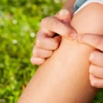 Lekari alarmiraju: Ova česta greška pri vađenju krpelja može biti opasna