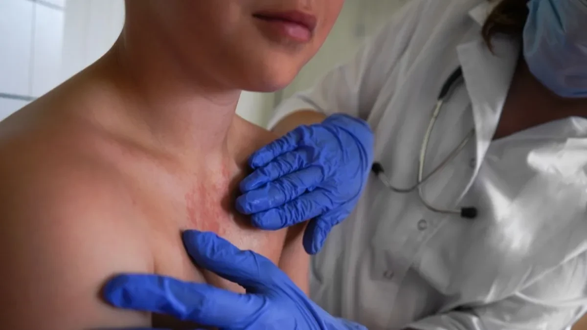 Može izazvati infekcije grla, kože, mozga, opasna je haos: Ovo su simptomi bolesti koja napada najčešće decu,