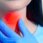 ZBOGOM HAŠIMOTO! Nova terapija rešava autoimuni problem sa štitnom žlezdom