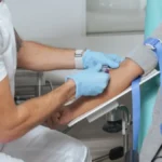 3 skrivena krivca za visok holesterol: Nemaju veze sa hranom, a razaraju krvne sudove