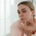 Istina o bubuljicama: Da li vam lice zaista otkriva zdravstveno stanje?