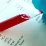 Krvna slika otkriva više nego što mislite: Ovi parametri mogu ukazivati na srčane probleme