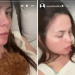 Milica Pavlović sva u ogrebotinama i crvenilu! Svi se ptiaju šta se desilo pevačici