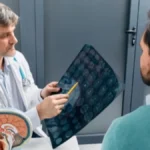 Neurolog otkriva: Ove 3 stvari nikada ne radim jer uzrokuju moždani udar