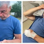 Albanci pretukli Srbina Svetu! Krvav je završio u bolnici