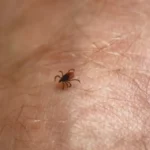 Krpelji će od ovoga bežati kao ludi: Stavite ovu stvar u džep, i zaštita je zagarantovana!