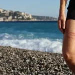 Opasnosti u grčkom moru: Šta uraditi kod uboda otrovne ribe, meduze ili ježa