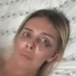 Ava Karabatić naga vezana za krevet: Pokazala modrice, jeziva fotka ledi krv u žilama! (FOTO 18+)