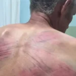 Horor kod Zubinog Potoka! Kurtijevi policajci Srbina vezali za drvo i tukli crevom, terali ga da prizna ratni zločin