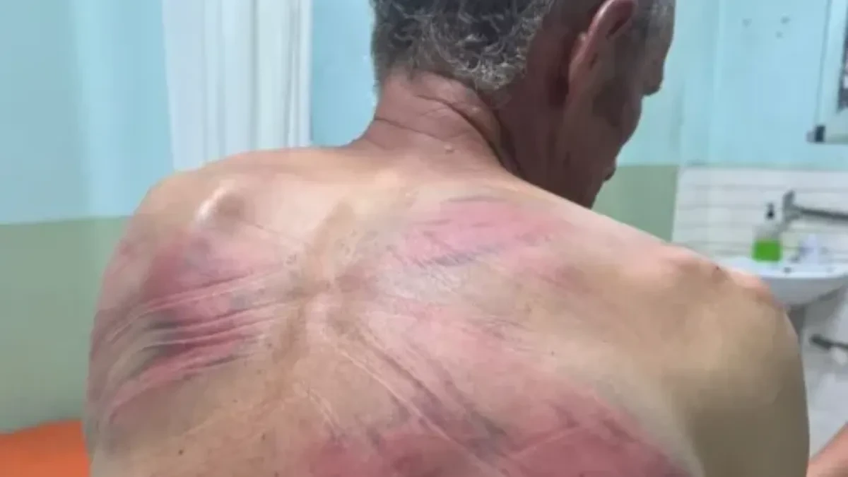 Horor kod Zubinog Potoka! Kurtijevi policajci Srbina vezali za drvo i tukli crevom, terali ga da prizna ratni zločin