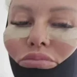 "Ja sam kao Frankeštajnova nevesta": Viktorija (41) potpuno je preoblikovala celo telo, uključujući i "intimu", evo kako sada izgleda