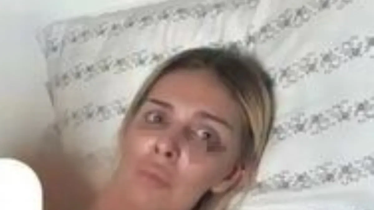 Pojavio se izveštaj Ave Karabatić iz policije! Otkrila sve o nasilju: