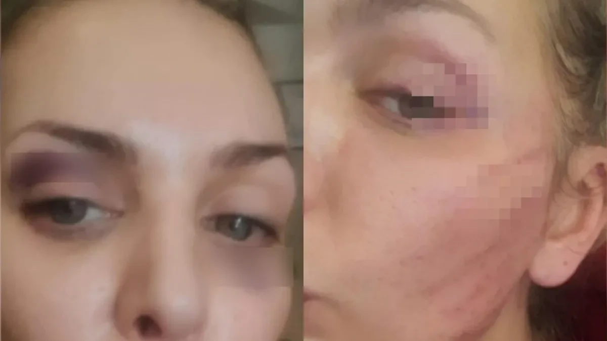 Prebio je, a sad se pomirila sa njim?! Ava Karabatić posle brutalog nasilja opet sa bivšim: