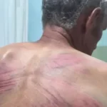 Šiptarski teroristi čereče Srbe, Brisel se pravi mutav! Srbin u teškom stanju, ima teške povrede glave!