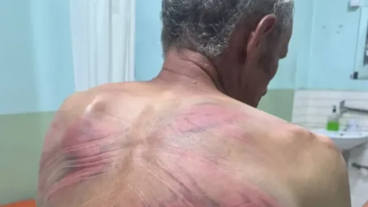 Šiptarski teroristi čereče Srbe, Brisel se pravi mutav! Srbin u teškom stanju, ima teške povrede glave!