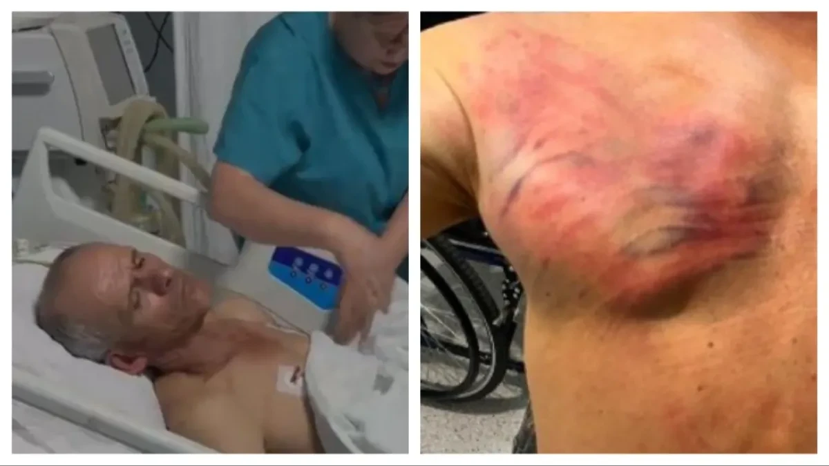 Srbin kog je tukla Kurtijeva policija u šok sobi! Vezali su ga za drvo i tukli crevom, ima teške povrede