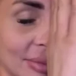 Unakažena: Mađarica pokazala lice posle šamaranja u Beogradu, jezivo (VIDEO)