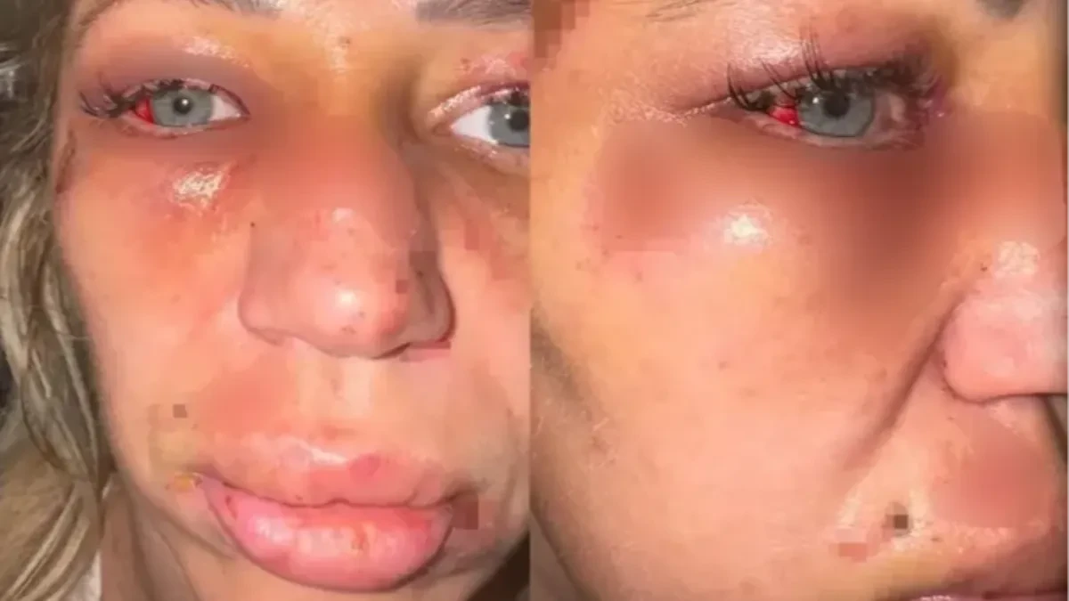 Influenserka objavila jezivi snimak nasilja: Muškarac je nokautirao, pa vukao po podu: