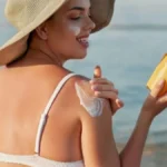 Izgoreli ste na suncu? Ne mažite jogurt – koži je potrebna drugačija nega