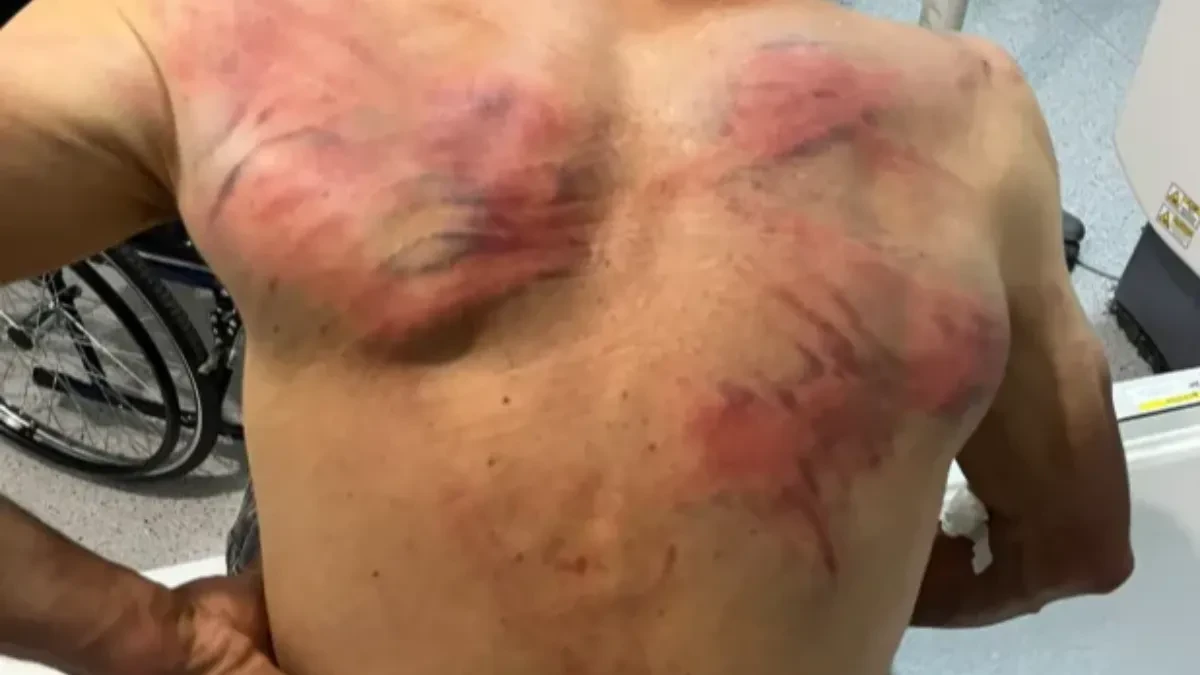Kurtijevi policajci koji su tukli Raškovića vraćeni na dužnost! Srpska lista: