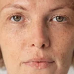Skupa kozmetika nije rešenje, ovo je još bolja stvar: Evo kako da od 3 sastojka kod kuće napravite kremu koja usporava starenje