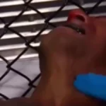 Uznemirujuće: UFC borac ležao nepomično, kolabirao za vreme borbe