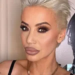 "Pao mi je vrh nosa" Dušica Jakovljević se hitno oglasila, lice joj u flasterima