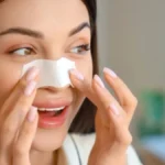 Spas za pore ili zamka za kožu? Evo šta dermatolozi kažu o trakama za mitisere